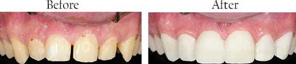 Alief dental images